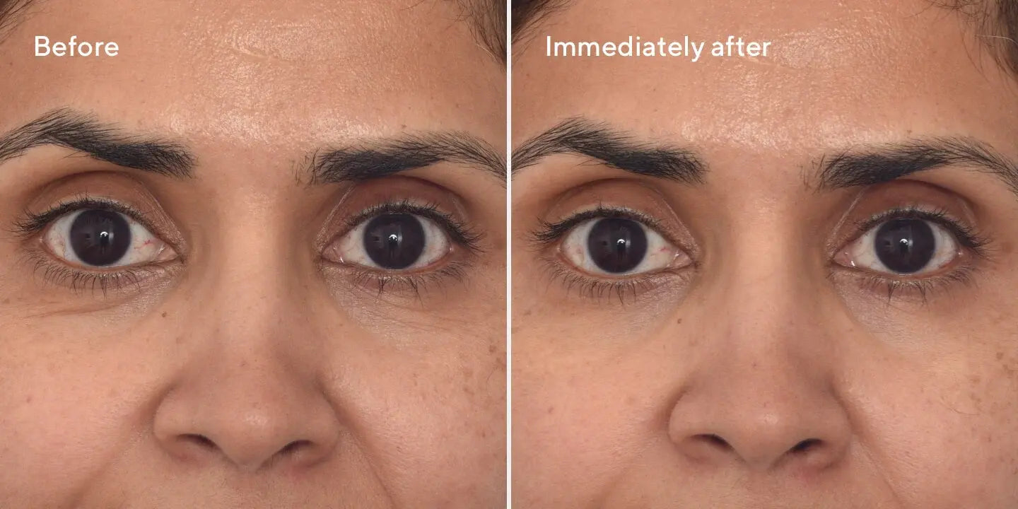 Murad Retinol Youth Renewal Eye Masks – 5 Pack Newcastle Skin Clinic