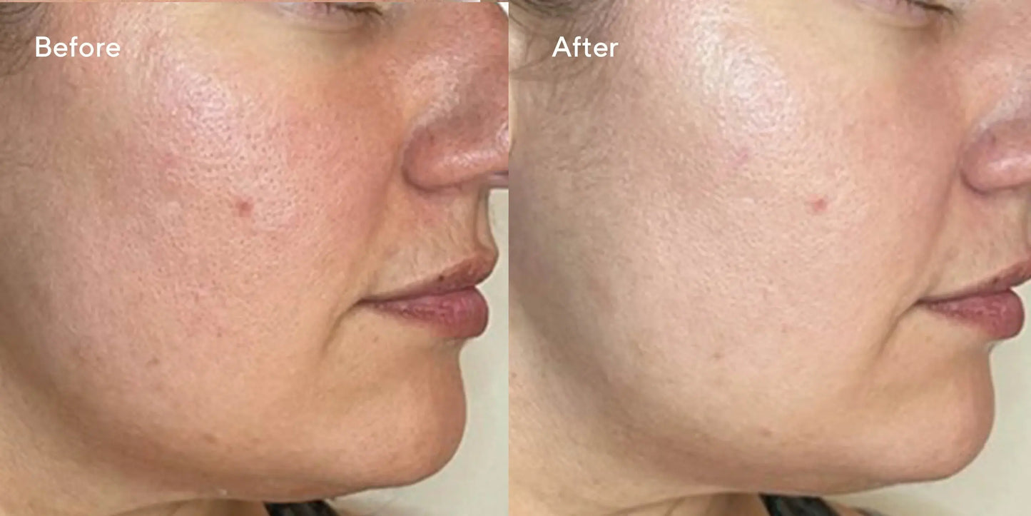 Murad Correct & Protect Serum Broad Spectrum SPF 45 30ml Newcastle Skin Clinic