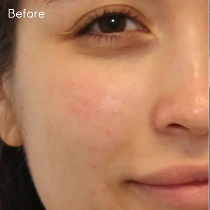 Murad Clarifying Cleanser 200ml Newcastle Skin Clinic