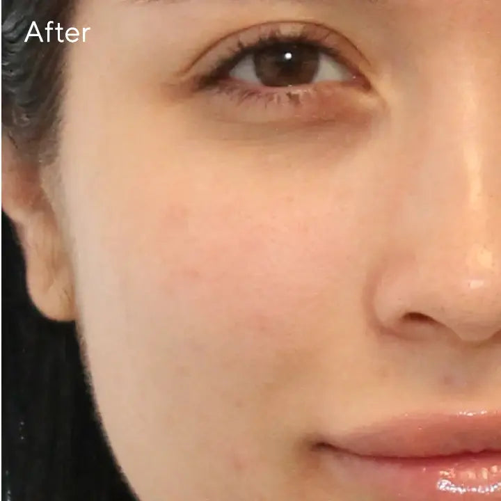 Murad Clarifying Cleanser 200ml Newcastle Skin Clinic