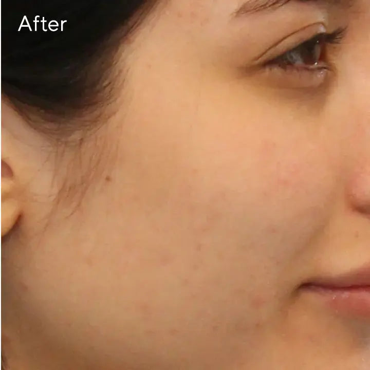 Murad Clarifying Cleanser 200ml Newcastle Skin Clinic