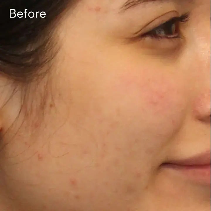 Murad Clarifying Cleanser 200ml Newcastle Skin Clinic