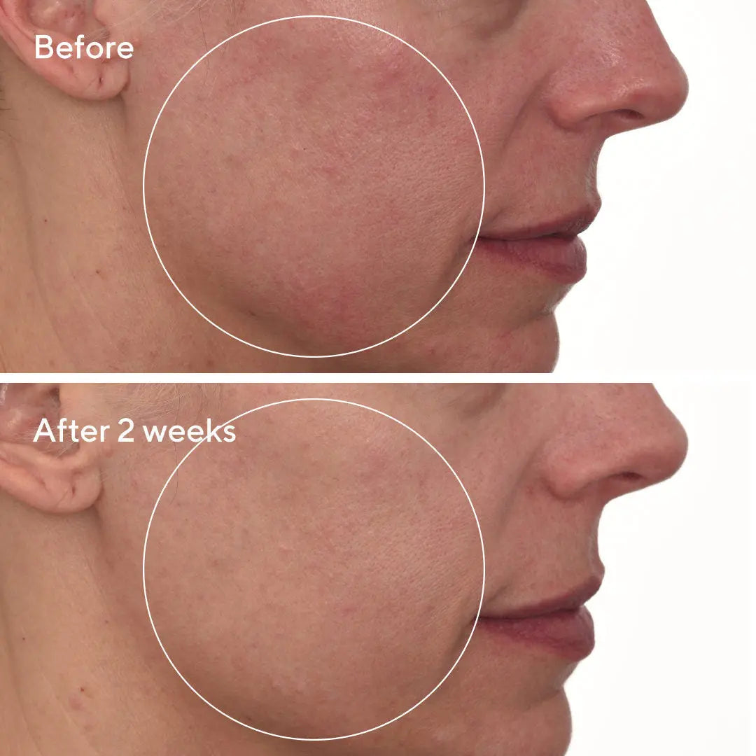 Murad Cellular Hydration Repair Cream 50ml Newcastle Skin Clinic