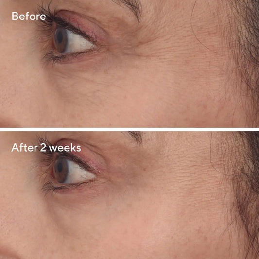 Murad Retinal Resculpt Eye Treatment 15ml Newcastle Skin Clinic