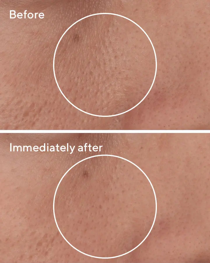 Murad Targeted Pore Corrector – 15ml  Newcastle Skin Clinic