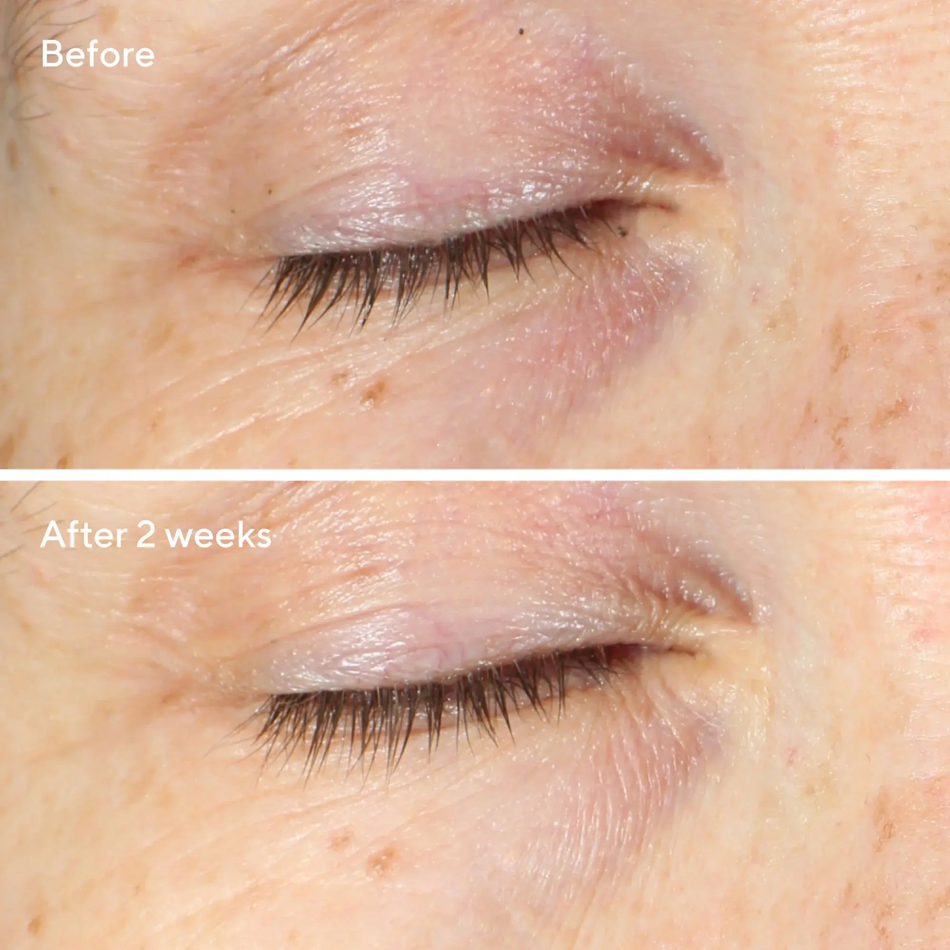 Murad Vita-C Eyes Dark Circle Corrector – 15ml  Newcastle Skin Clinic